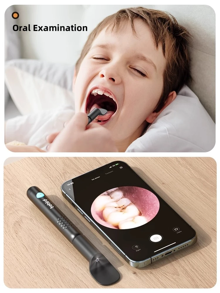 Bebird R3 Ear Cleaner Smart Vi - огляд і ціна Pet Ear Cleaner